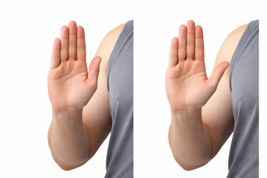 Thumb Abduction (Lift Thumb Away From Palm)